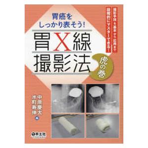 胃癌をしっかり表そう!胃X線撮影法虎の巻-撮影手技を基本から応用まで
