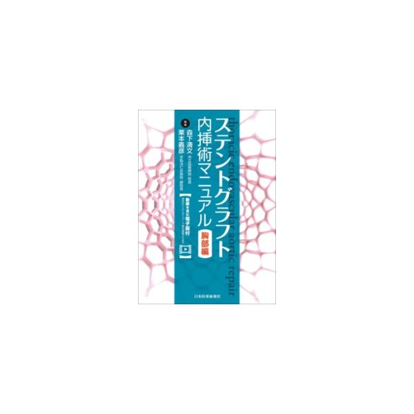 ステントグラフト内挿術マニュアル 胸部編 : 有隣堂ヤフーショッピング
