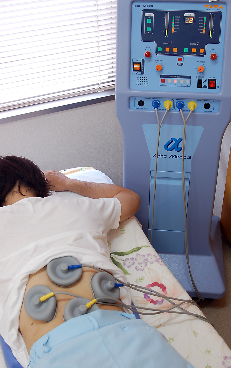 プロテクノPNF | 日本シーエイチシー株式会社