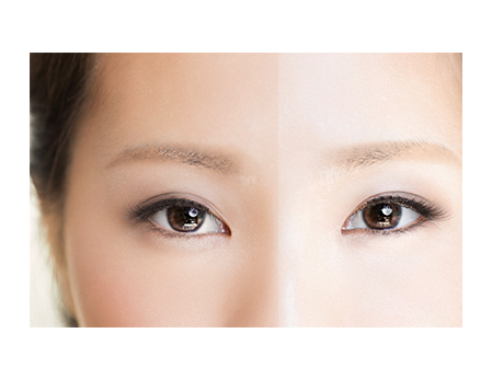 LNC ディアセラム | 株式会社日本生物製剤