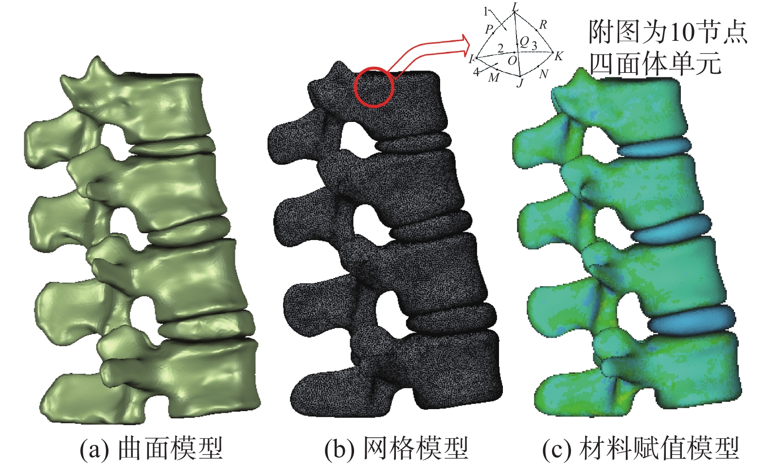 胸腰椎骨内固定手术仿真模型优化研究