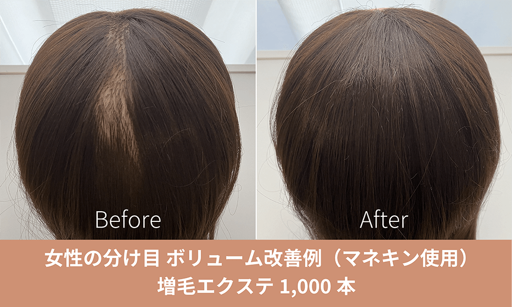 増毛エクステサロン きのした｜ご新規様1000本4680円(税込)でご提供