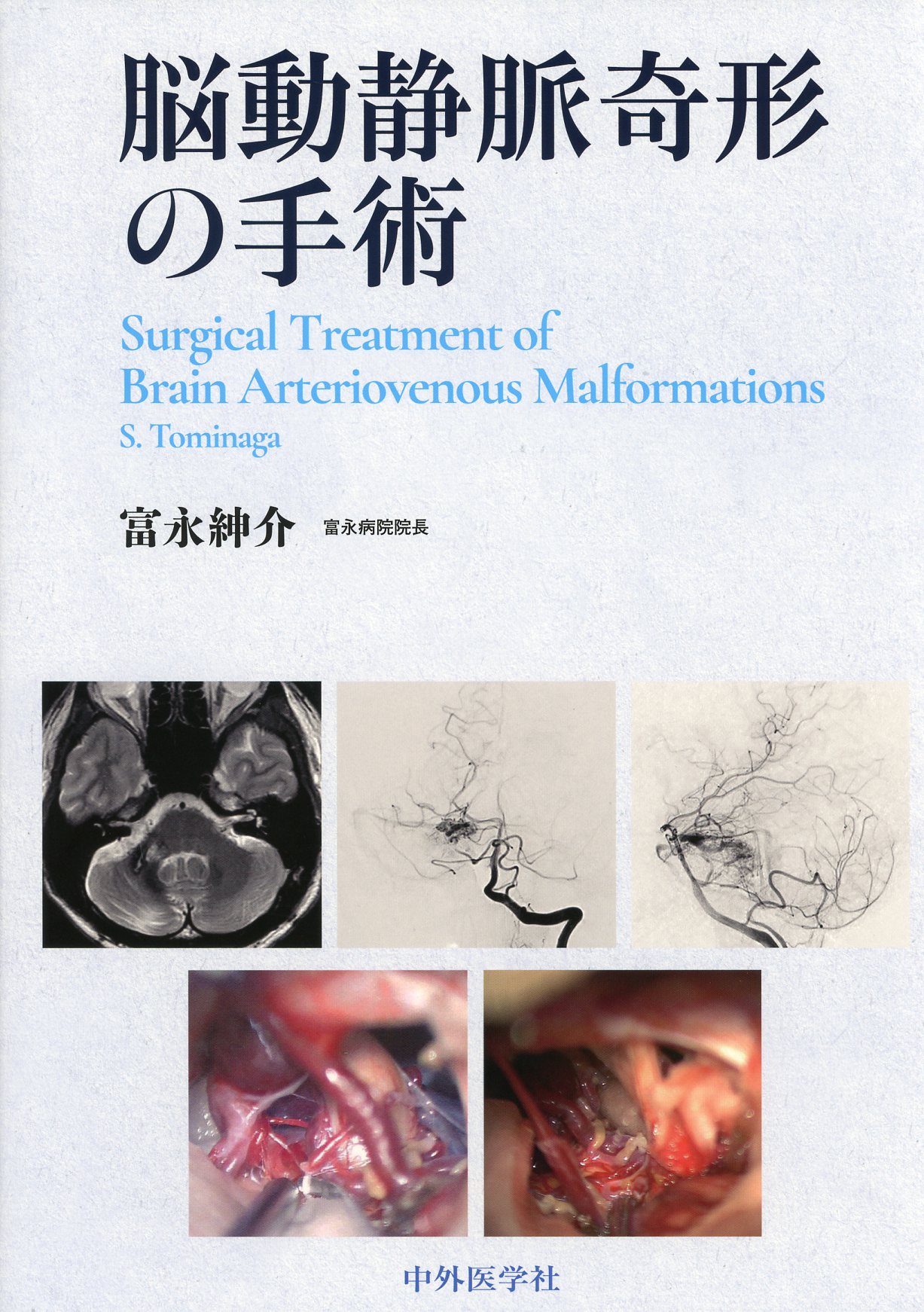 脳動静脈奇形の手術 / 高陽堂書店