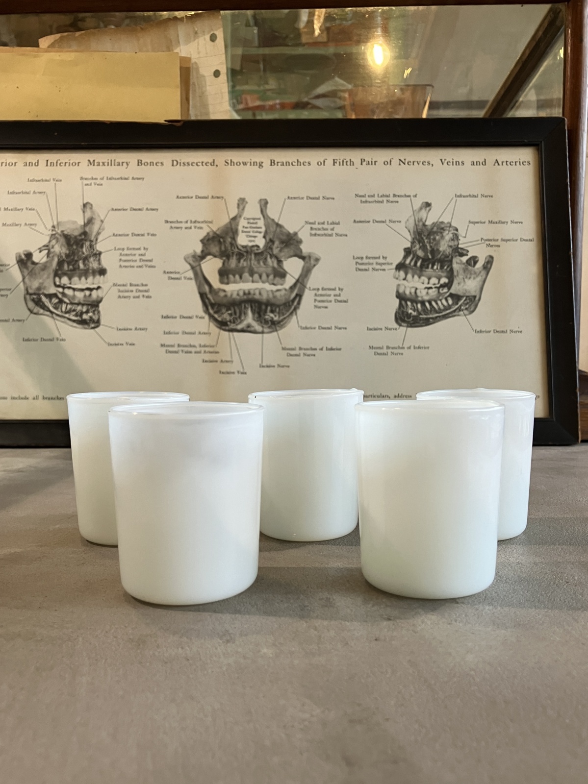 1930'S 40'S ミルクガラスシェード キャンドルホルダー 5pcs/SET. 5個