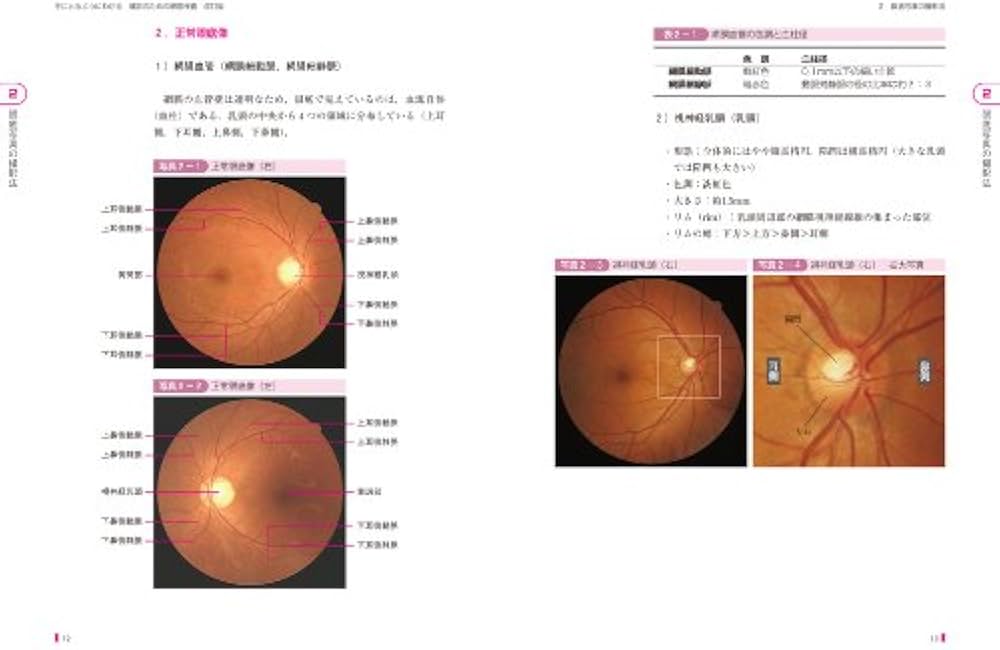 健診のための眼底検査 改訂版〜無散瞳カメラによる撮影と判定〜 (手に