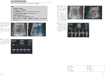 心臓超音波診断アトラス〜小児・胎児編〜 改訂版 (Atlas Series超音波
