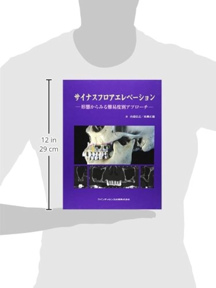 Amazon.co.jp: サイナスフロアエレベ-ション: 形態からみる難易度別