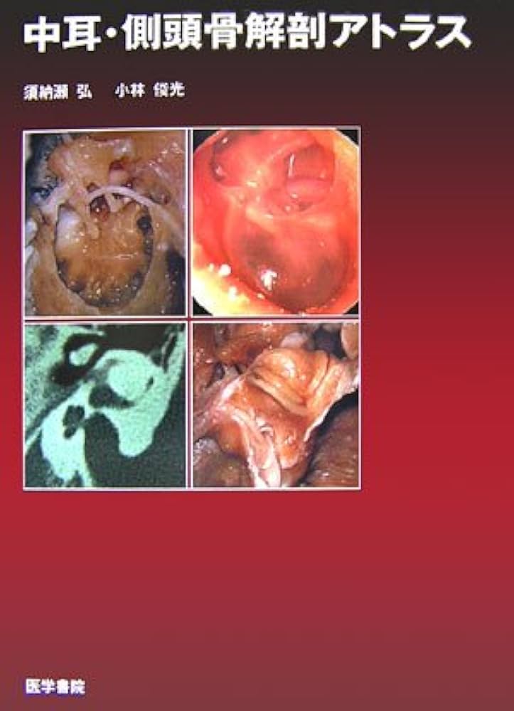 Amazon.co.jp: 中耳・側頭骨解剖アトラス : 本