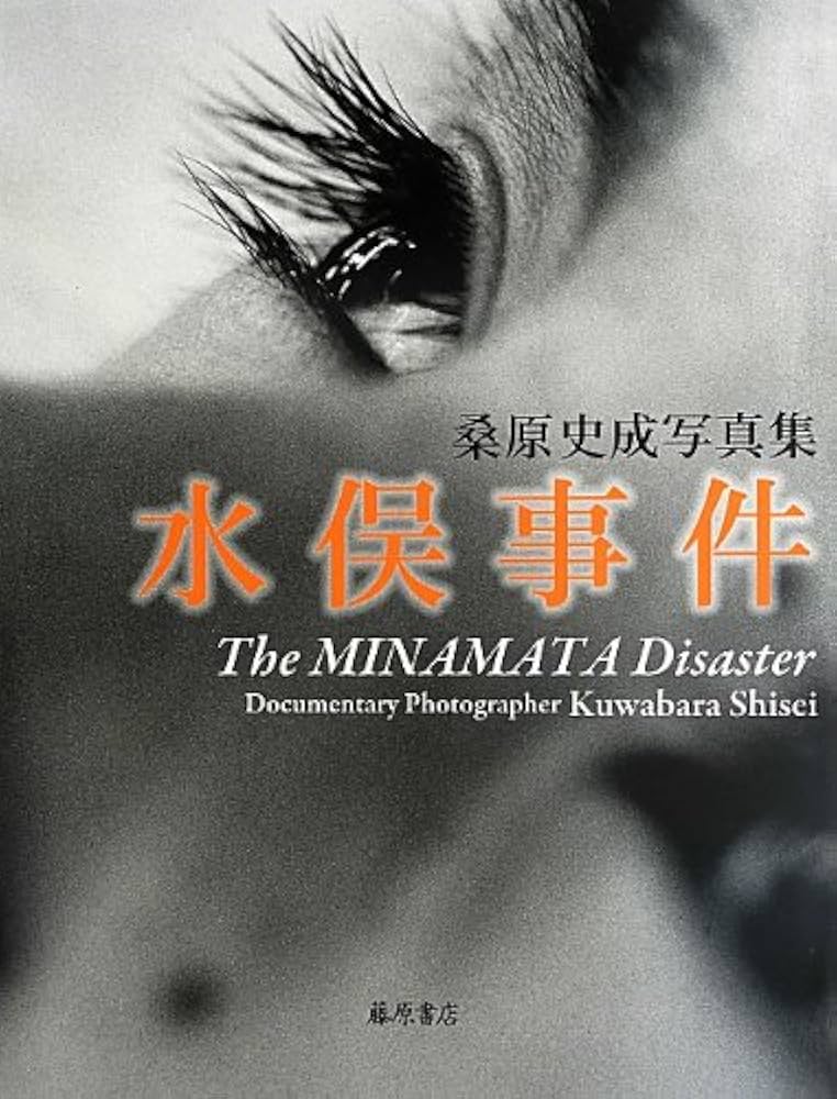 Amazon.co.jp: 水俣事件 The MINAMATA Disaster 桑原史成写真集 : 桑原