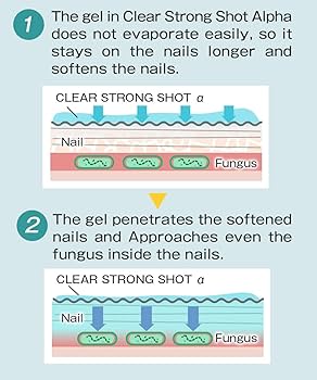 Amazon.co.jp: Medicated Gel That Penetrates Into Your Nails and