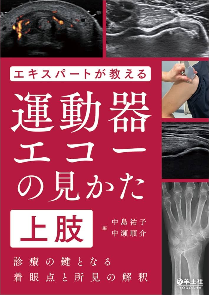 エキスパートが教える運動器エコーの見かた 上肢〜診療の鍵となる着眼
