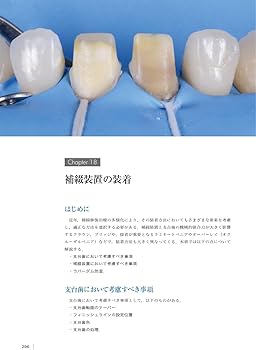 The Tooth Preparation: 補綴修復治療の成功を目指した支台歯形成