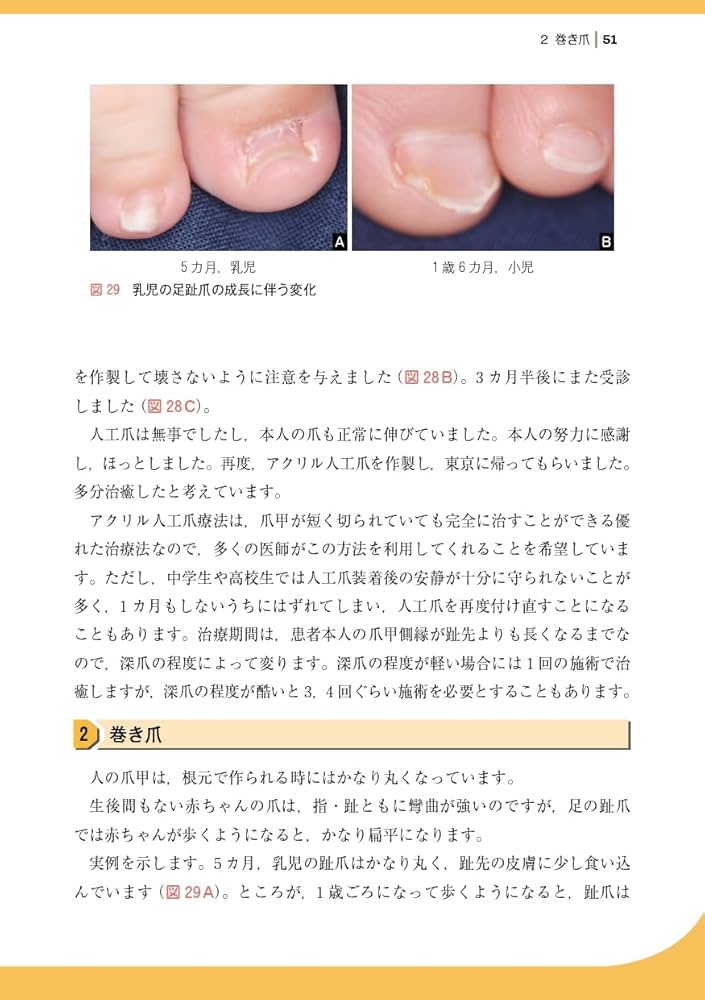 61x5P-ac77L._AC_UF1000,