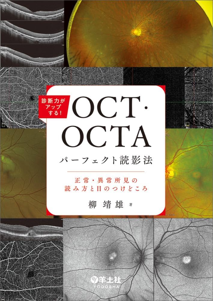 診断力がアップする！OCT・OCTAパーフェクト読影法〜正常・異常所見の
