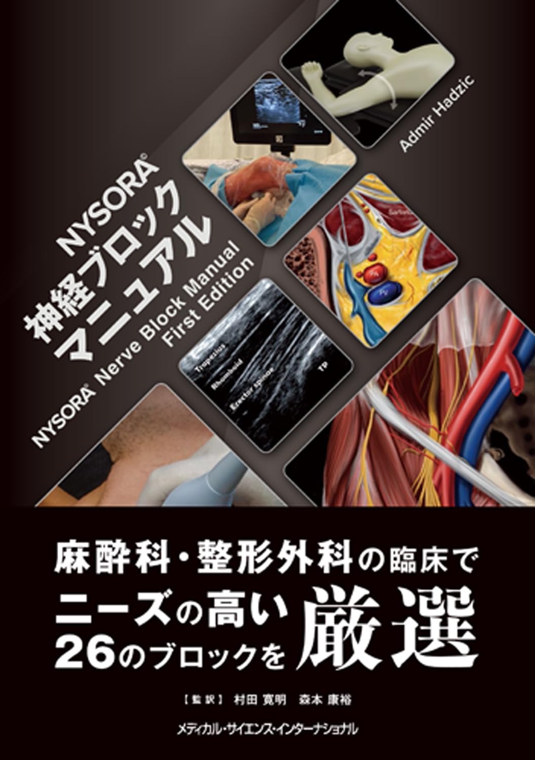 Amazon.co.jp: NYSORA© 神経ブロックマニュアル : 村田寛明, 森本康裕: 本