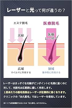 Amazon | トリア Tria パーソナルレーザー脱毛器プレシジョン レーザー