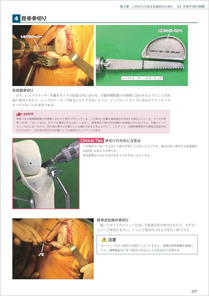 TKA・UKA 人工膝関節置換術パーフェクト〜人工膝関節全置換術・人工膝