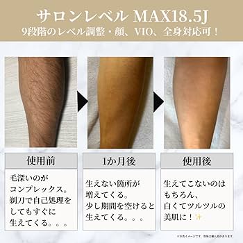 Amazon | 脱毛器 リムーザー Remozer 2 Pro メンズ 髭 脱毛機 VIO対応