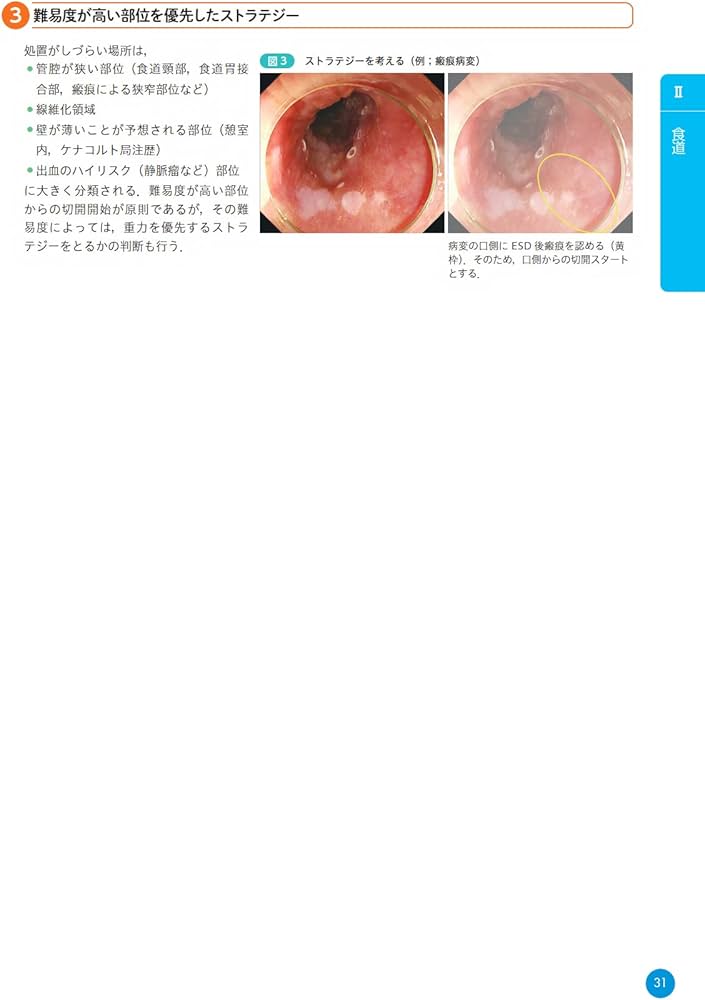 ザ・テキスト 食道・胃・十二指腸ESD | 大圃 研, 千葉 秀幸 |本 | 通販