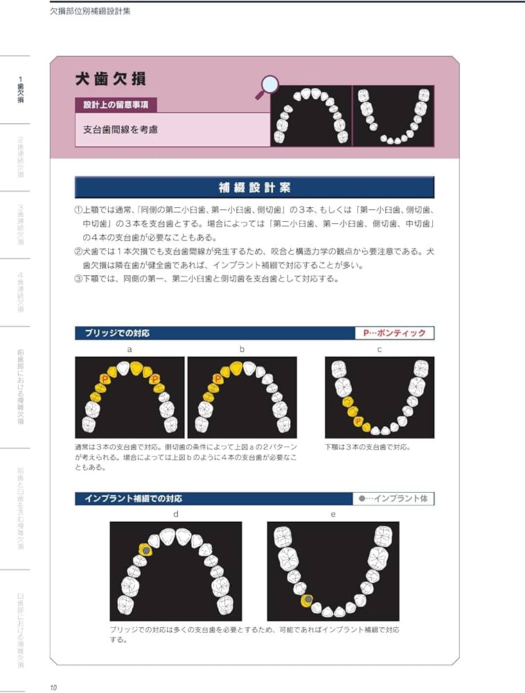 RESTORATIVE DESIGN & PRACTICAL OCCLUSION 補綴設計&設計集 | 本多
