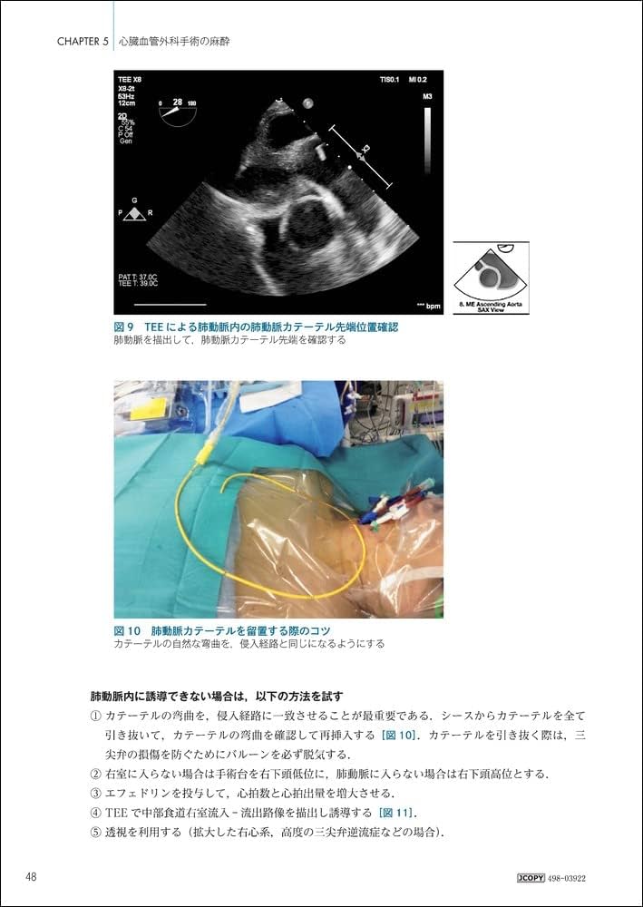 心臓血管外科手術虎の巻 | 山口 敦司 |本 | 通販 | Amazon