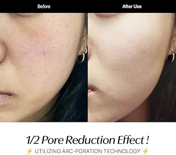 Amazon.com: CELORABY Potension Penta-Shot Glass Skin Glow Booster