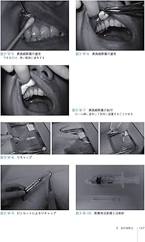 歯科麻酔学 第8版 | 福島 和昭, 一戸達也, 北畑 洋, 嶋田 昌彦, 丹羽