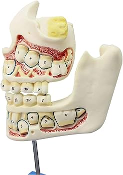 Amazon.co.jp: 歯列模型 乳歯、永久歯、子どもの歯と顎の発達モデル