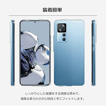 Amazon.co.jp: UOWORLD | Xiaomi Redmi Note 10T / 10JE (XIG02