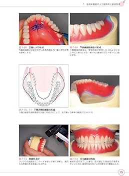 最新歯科技工士教本 有床義歯技工学 第2版 | 全国歯科技工士教育協議会