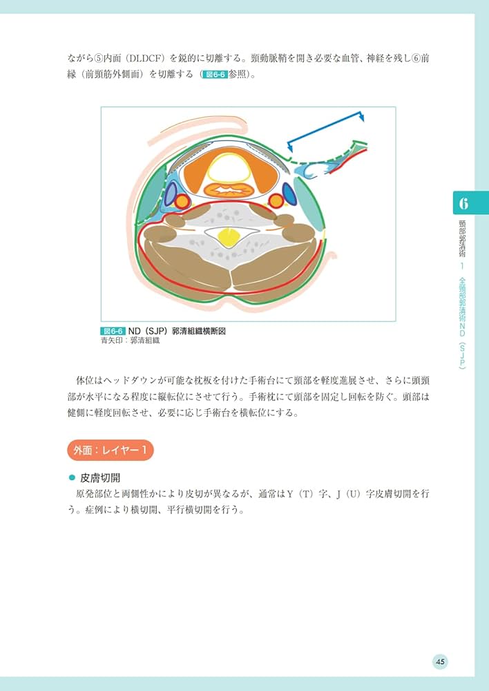 頭頸部がん手術ノート 輪層の外科 | 長谷川 泰久 |本 | 通販 | Amazon