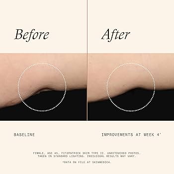 Amazon.com: SkinMedica Firm & Tone Lotion for Body - Ideal Body