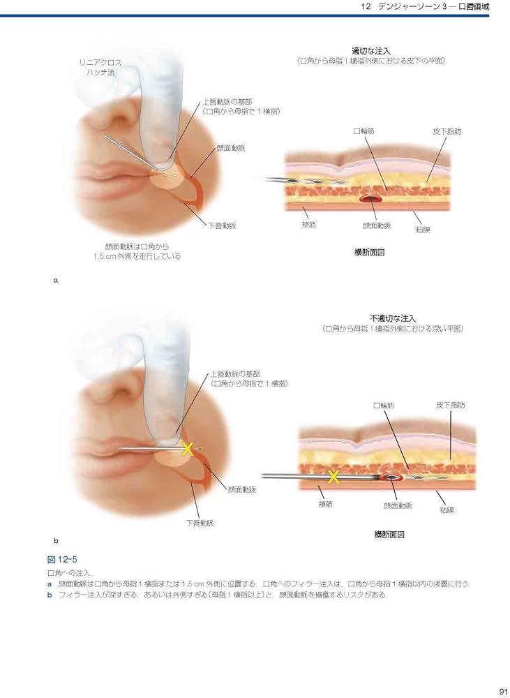 Facial Danger Zones 日本語版（フェイシャルデンジャーゾーン）［Web
