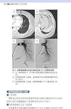 日本医大式 脳卒中ポケットマニュアル 第2版 | 木村 和美, 西山 康裕