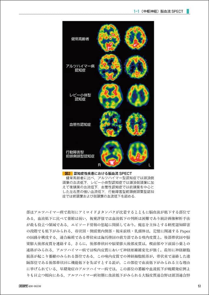 新 核医学テキスト | 絹谷 清剛, 若林 大志 |本 | 通販 | Amazon