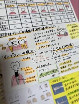 Amazon.co.jp: 歯科衛生士 国家試験 勉強ノート まとめノート DH