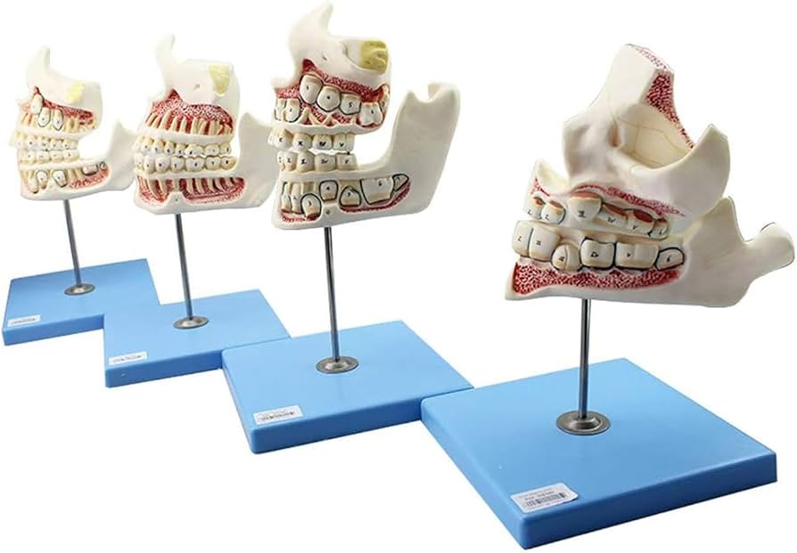Amazon.co.jp: 歯列模型 乳歯、永久歯、子どもの歯と顎の発達モデル