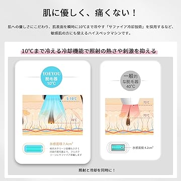 Amazon.co.jp: YOEYOU 脱毛器: U7 脱毛器