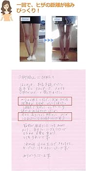 返金保証付】O脚矯正プログラム「福辻式」DVD-サンダル,インソール