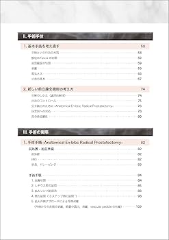 Amazon.co.jp: 根治のための前立腺全摘術の新しい考え方−最新の