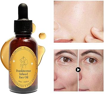 Amazon.com: Frankincense Resin Oil for Face, Frankincense Oil for
