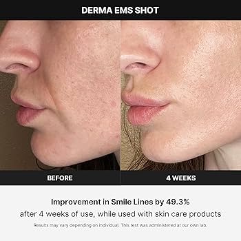 Medicube Age-R Derma Shot Massager : Amazon.co.uk: Beauty