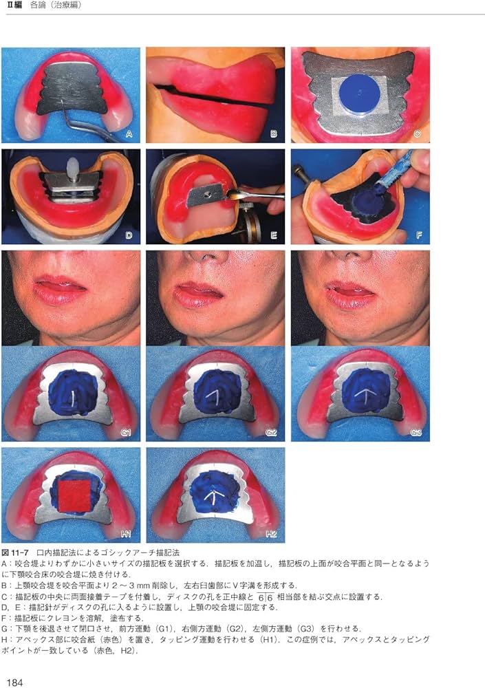 無歯顎補綴治療学 第4版 | 市川 哲雄, 大川 周治, 大久保 力廣, 水口