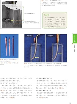 根管治療のクリニカルメソッド | 長谷川 智哉, 木方 一貴, 宮本 侑果