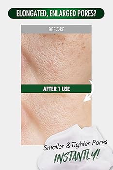 Amazon.com: [K-Beauty] Neogen Dermalogy Pore Zero Peeling Mousse