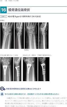 Amazon.co.jp: 「考える」外傷整形外科! : 土田 芳彦: 本