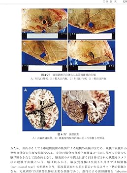 エッセンシャルシリーズ NEWエッセンシャル 法医学 第6版 | 髙取 健彦