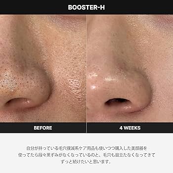 Amazon.co.jp: メディキューブ AGE-Rスキンブースターショット 【1日5