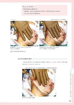 顔の美容外科手術 第2版 | 飯田秀夫 |本 | 通販 | Amazon