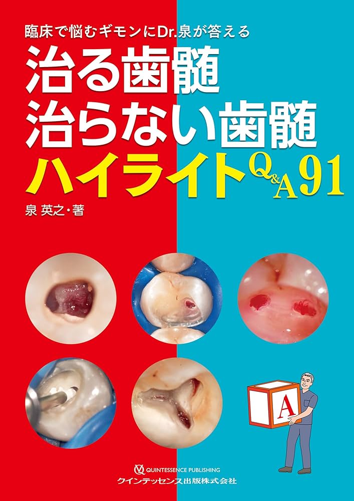 Amazon.co.jp: 治る歯髄 治らない歯髄 ハイライトQ&A91: 臨床で悩む